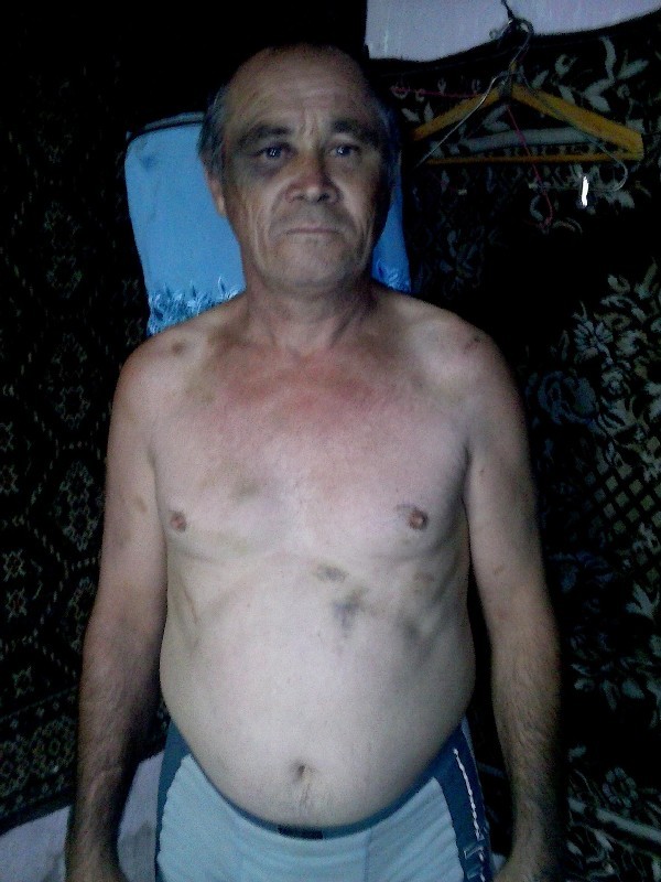На снимке, сделанном  сыном пострадавшего, видно,  что у Александра Альбрандта не осталось места, к которому  не приложились бы тяжелые кулаки и ноги полицейских.