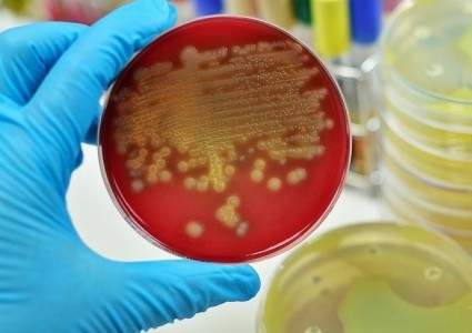 Стафилококк и кишечная палочка обнаружены в поставляемой в Казахстан продукции из Кыргызстана